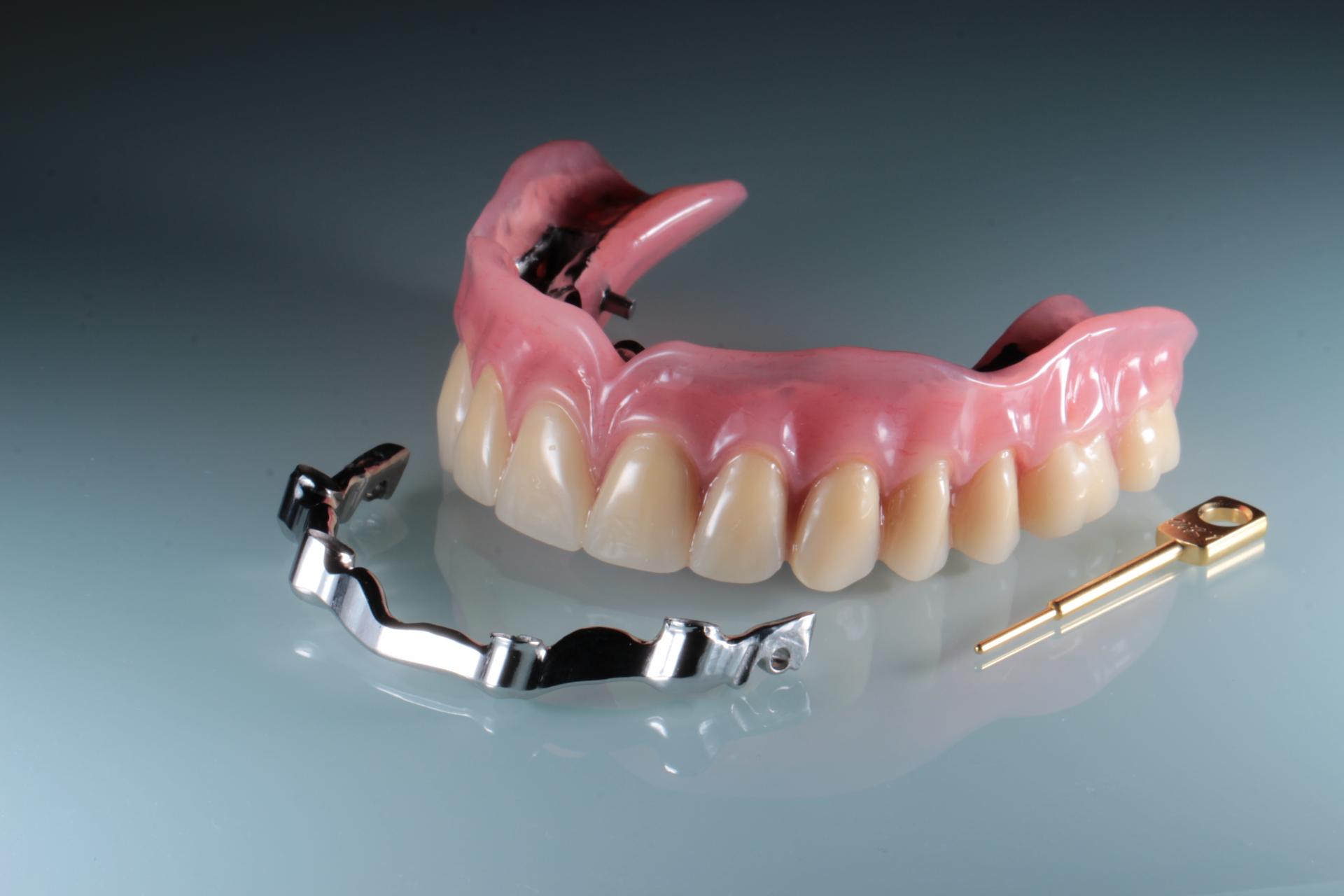 Prothèses dentaires amovibles - Dentiste Amouyal Paris 16