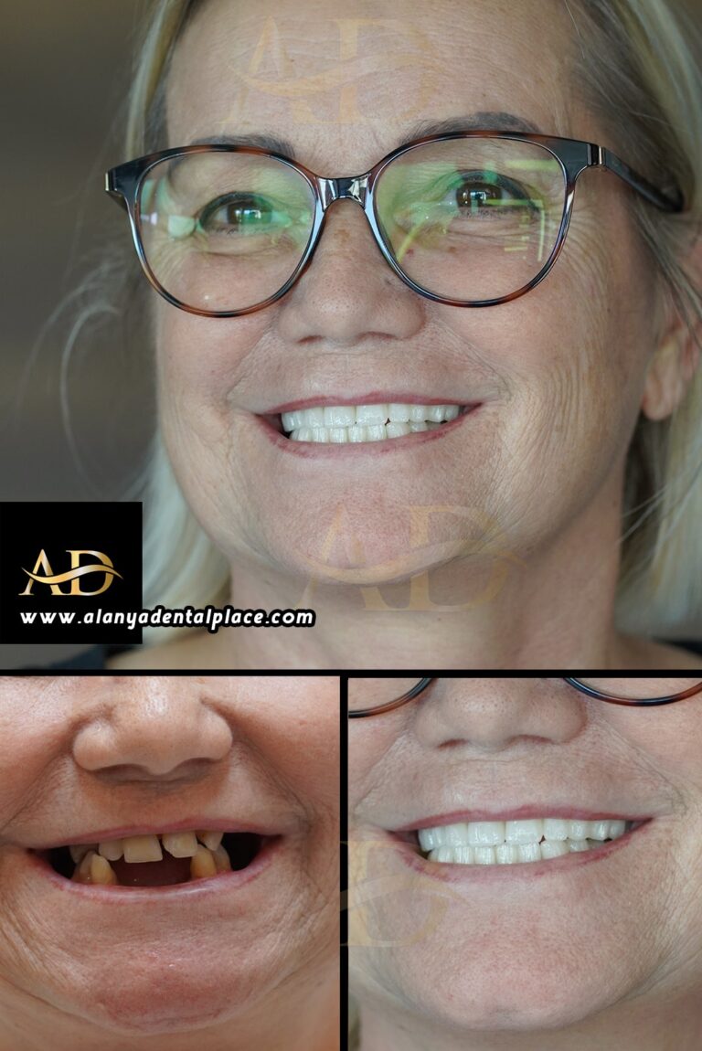 dental before after