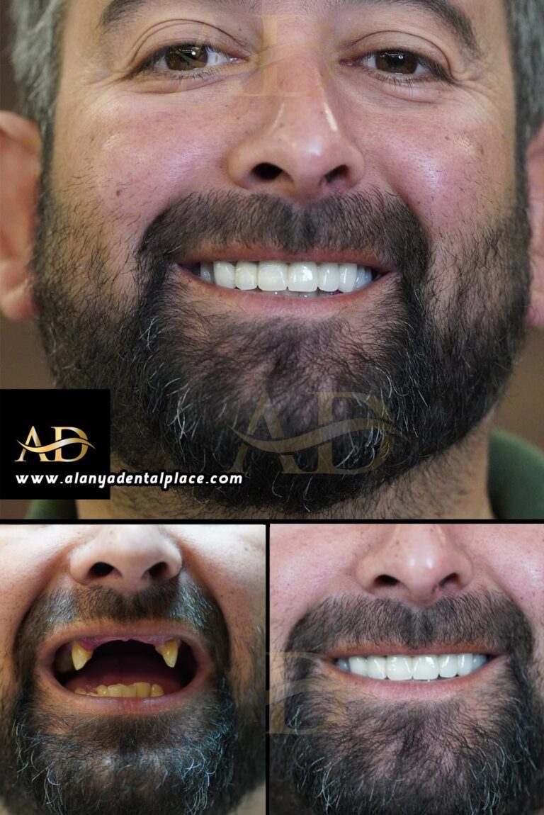 dental before after