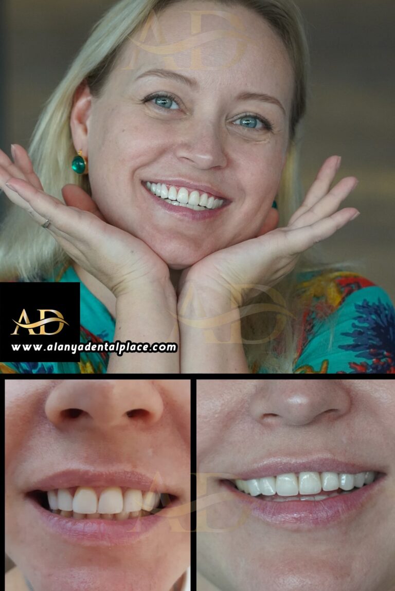 dental before after