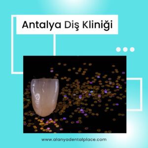 Antalya Dis Klinigi 2
