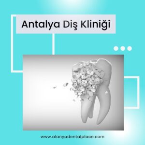 Antalya Dis Klinigi 9