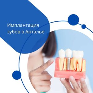 Имплантация зубов в Анталии