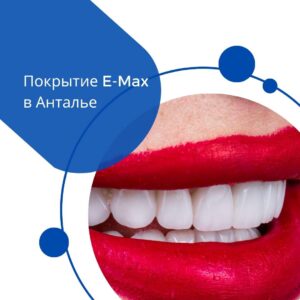 Покрытие E-Max в Анталье