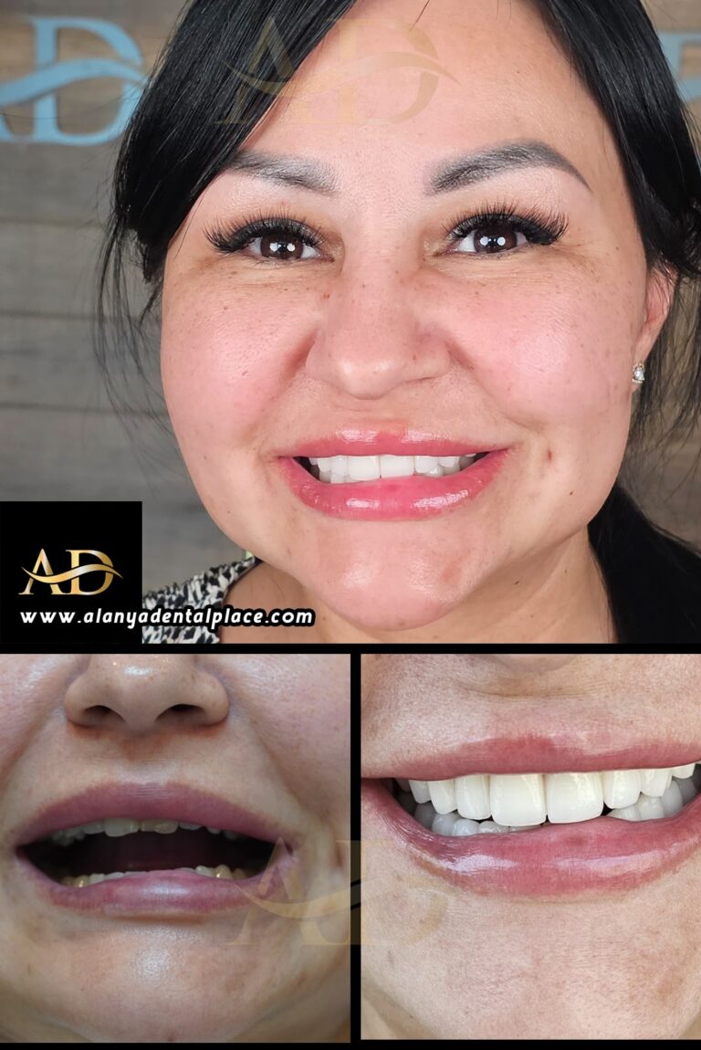 Dental Before After 2