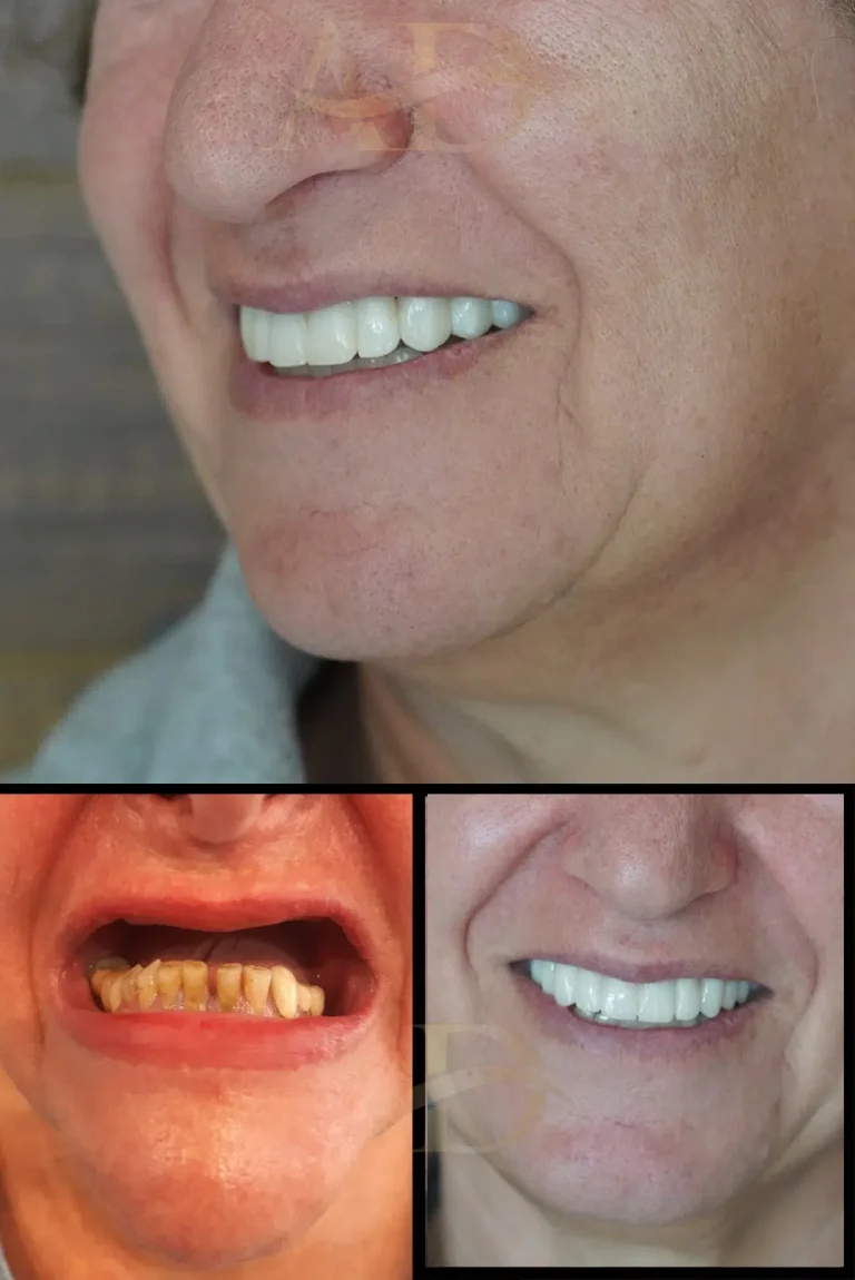 Dental-Before-After.jpg