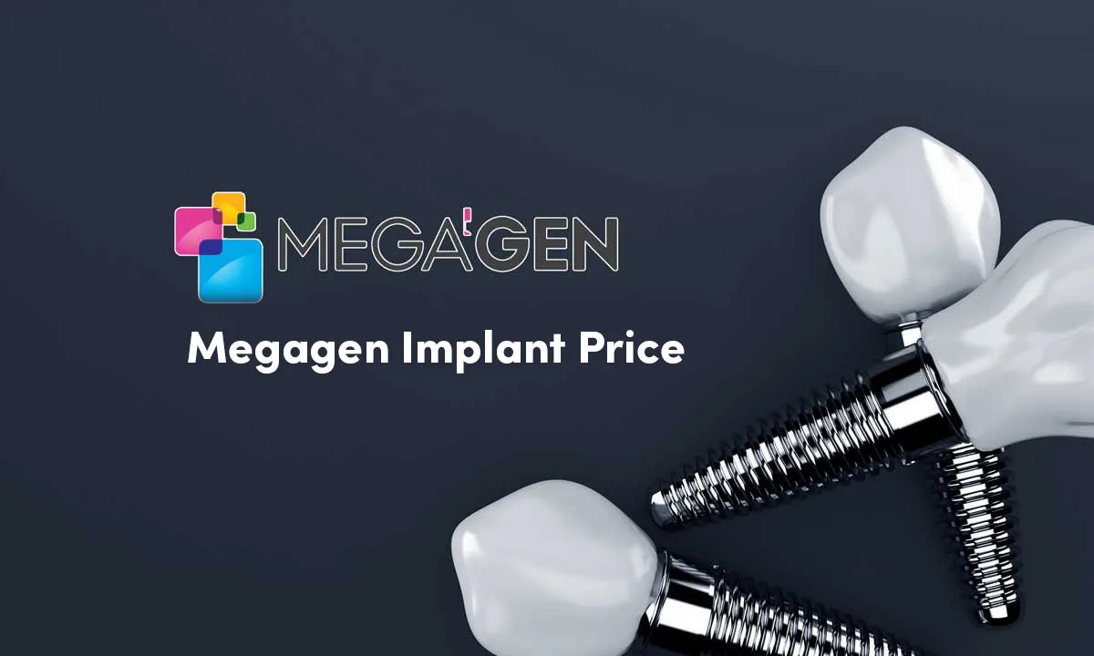 Megagen Implant Types and Prices