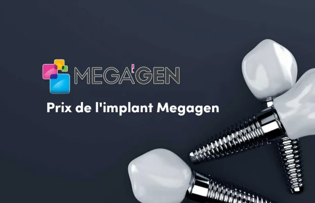 Types et Prix Des Implants Megagen